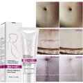 Skin Miracles Stretch Mark Cream Peeling Whitening Hautpflege Private Label Cream Hergestellt in chinesischem OEM ODM